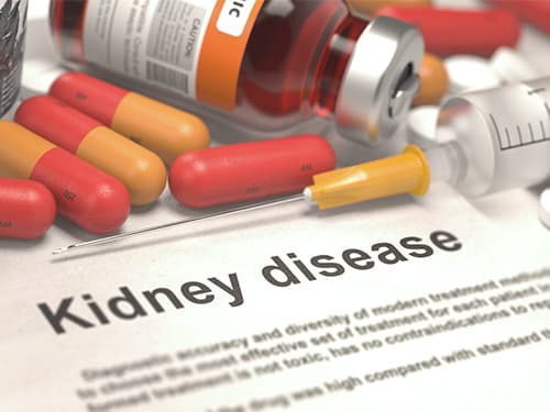 Introduction to renal drugs.JPG